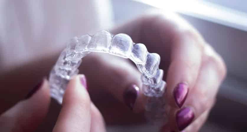clear retainers