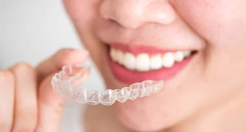 Invisible Braces Treatment