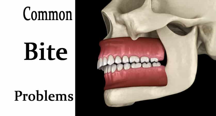 Common Bite Problems