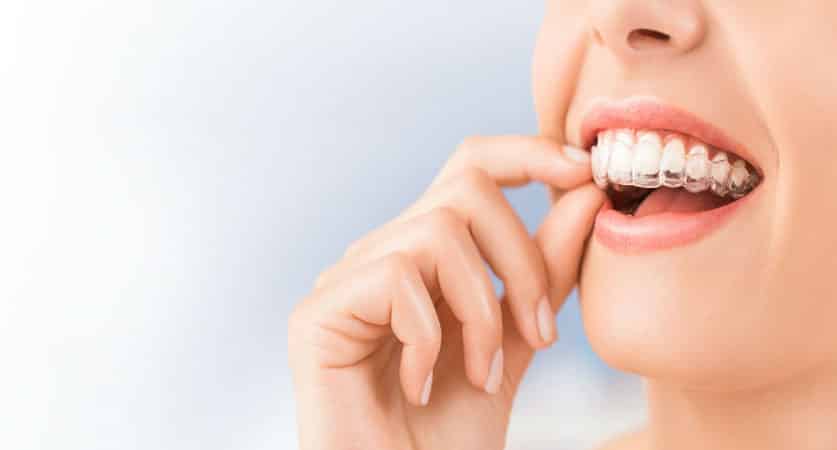 Tips for Invisalign