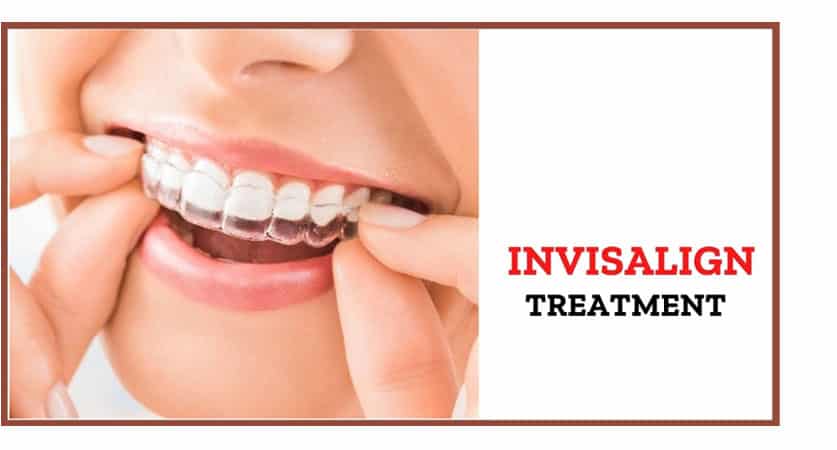 Invisalign Treatment