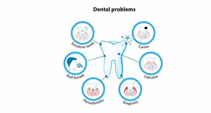 Dental Health Issues