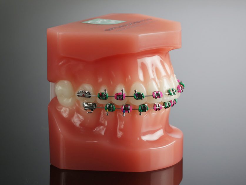 braces color wheel