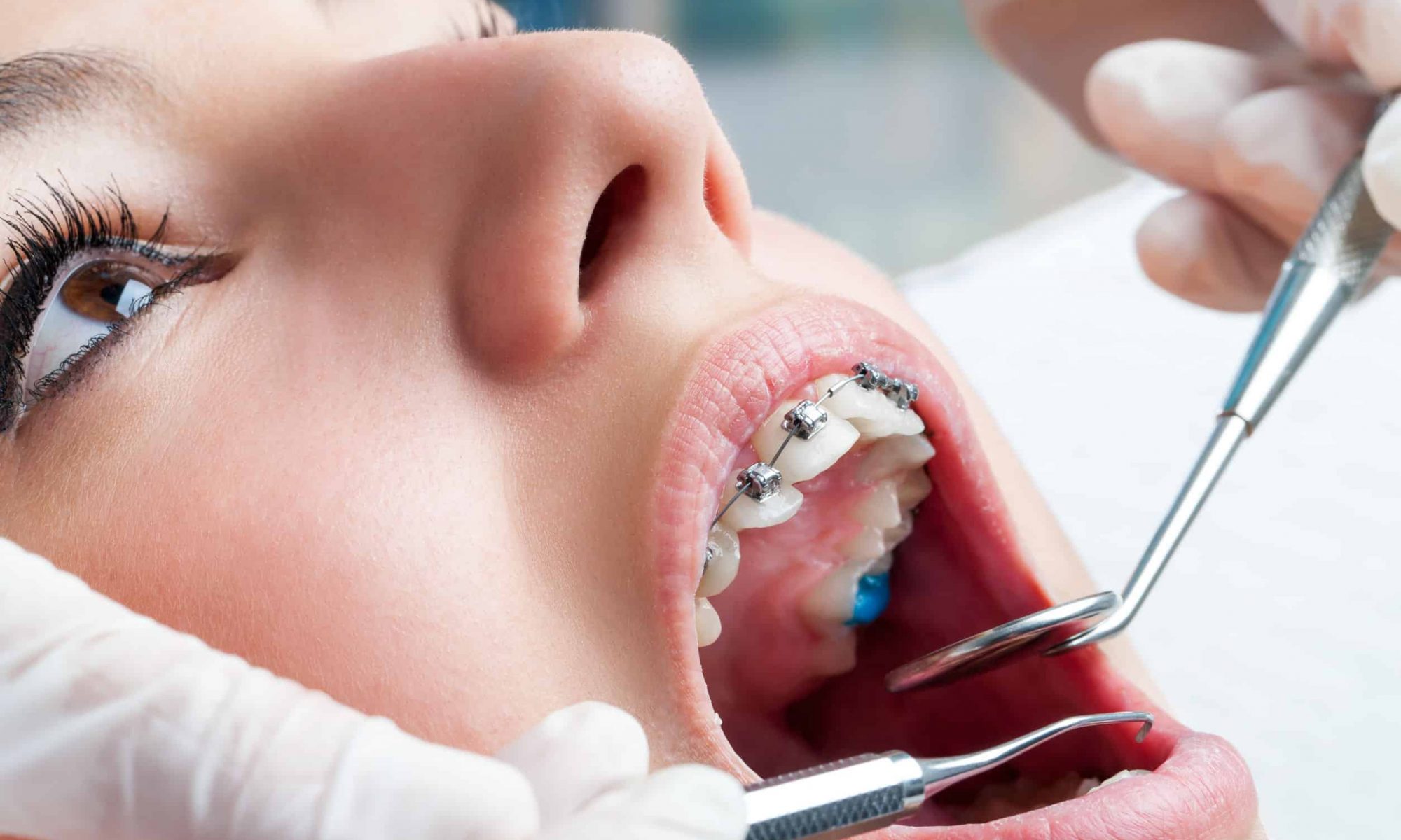 Orthodontist