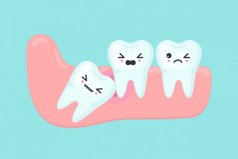Wisdom Tooth