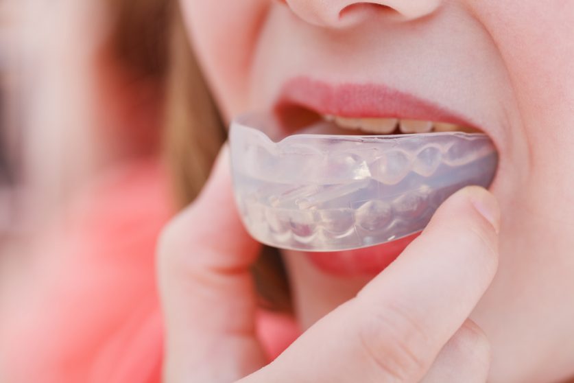 Mouthguards For Teeth