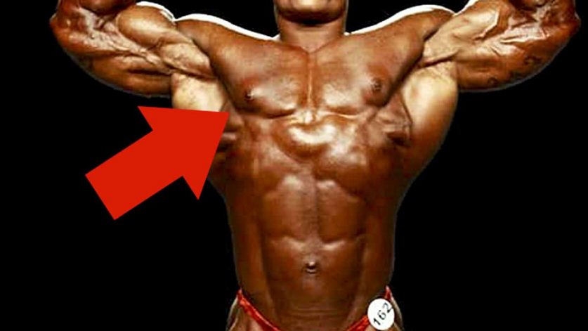 gynecomastia bodybuilder