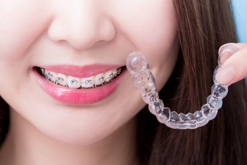 invisalign treatment