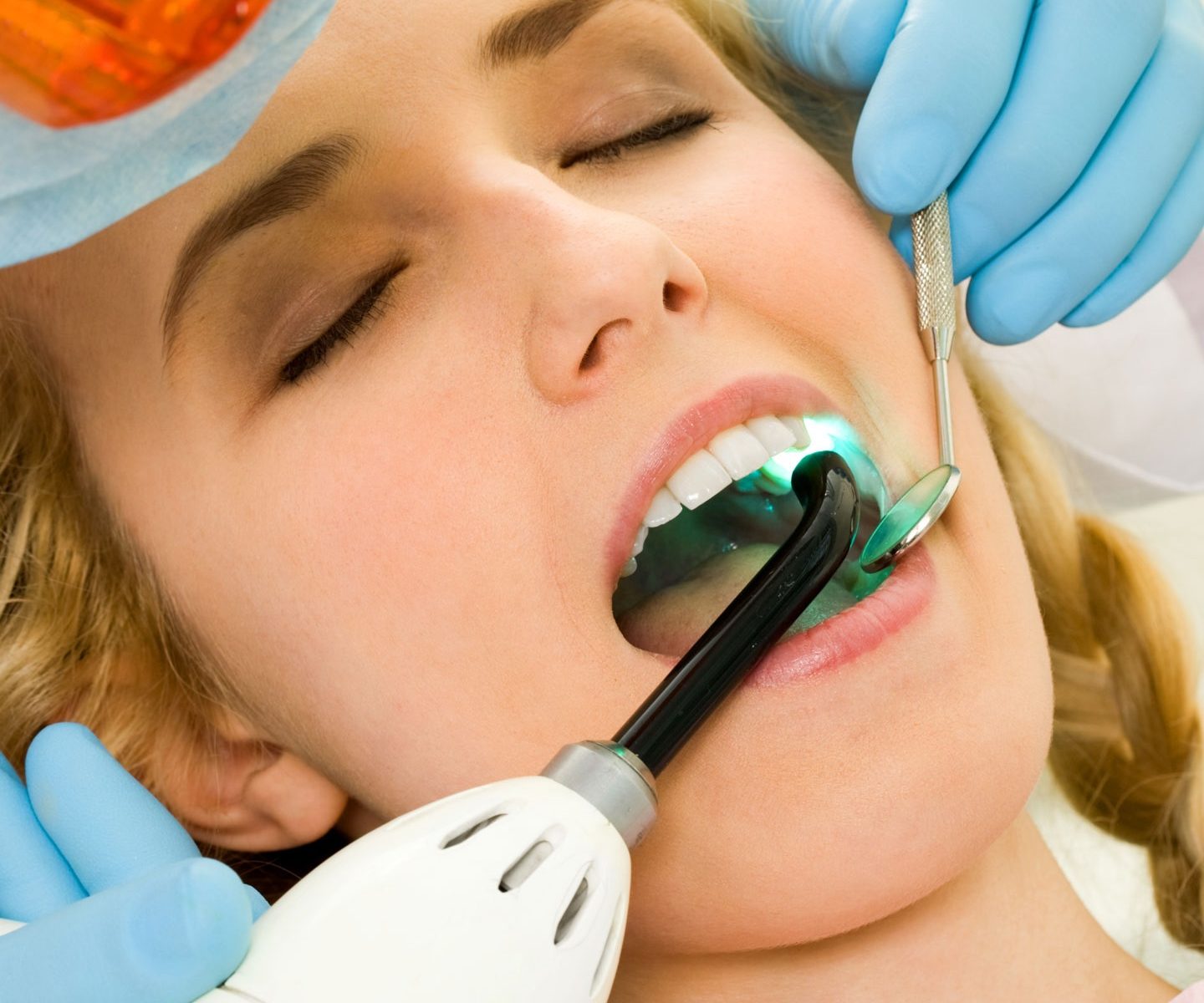 dental veneer specialist near me
