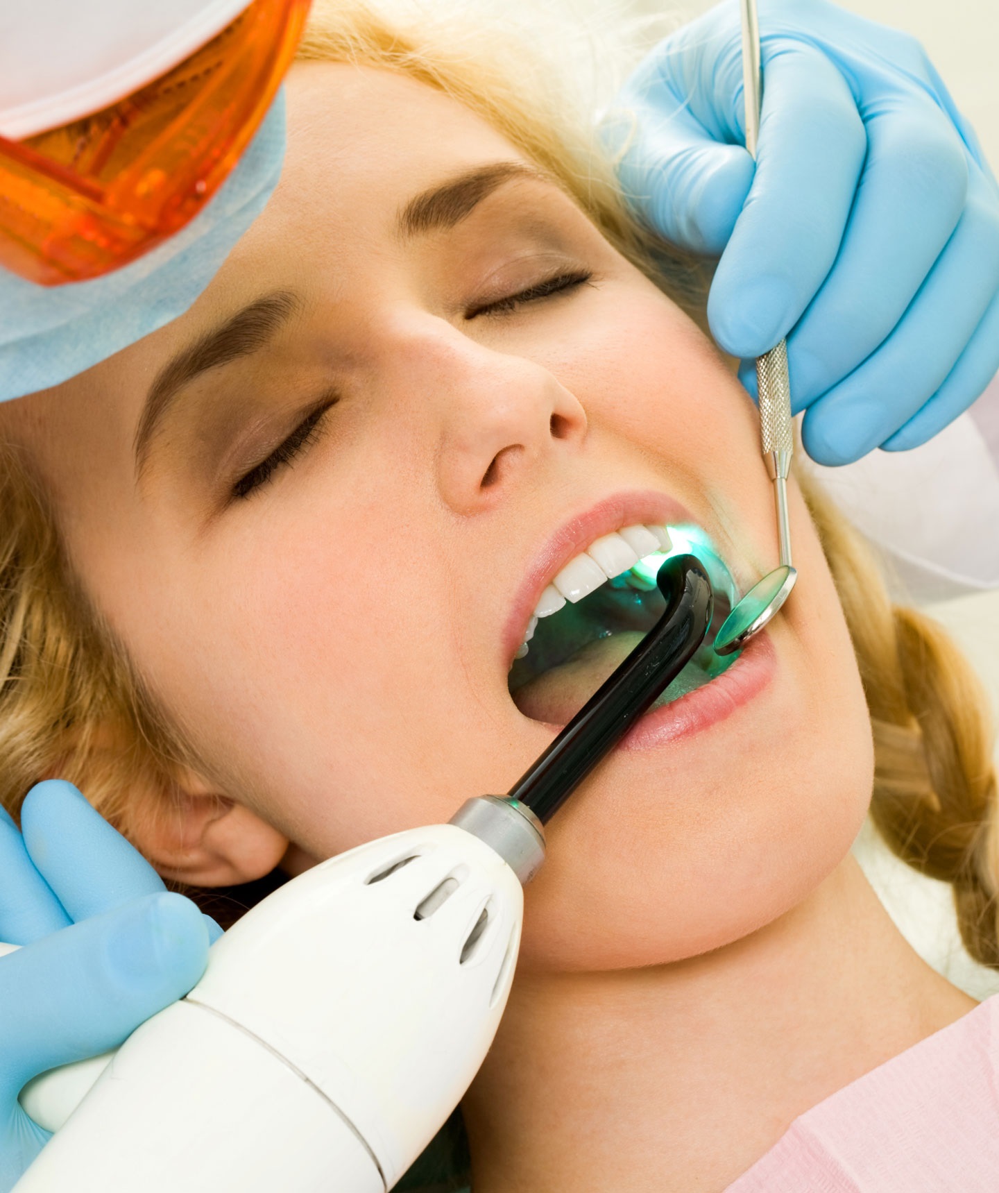 dental veneer specialist near me