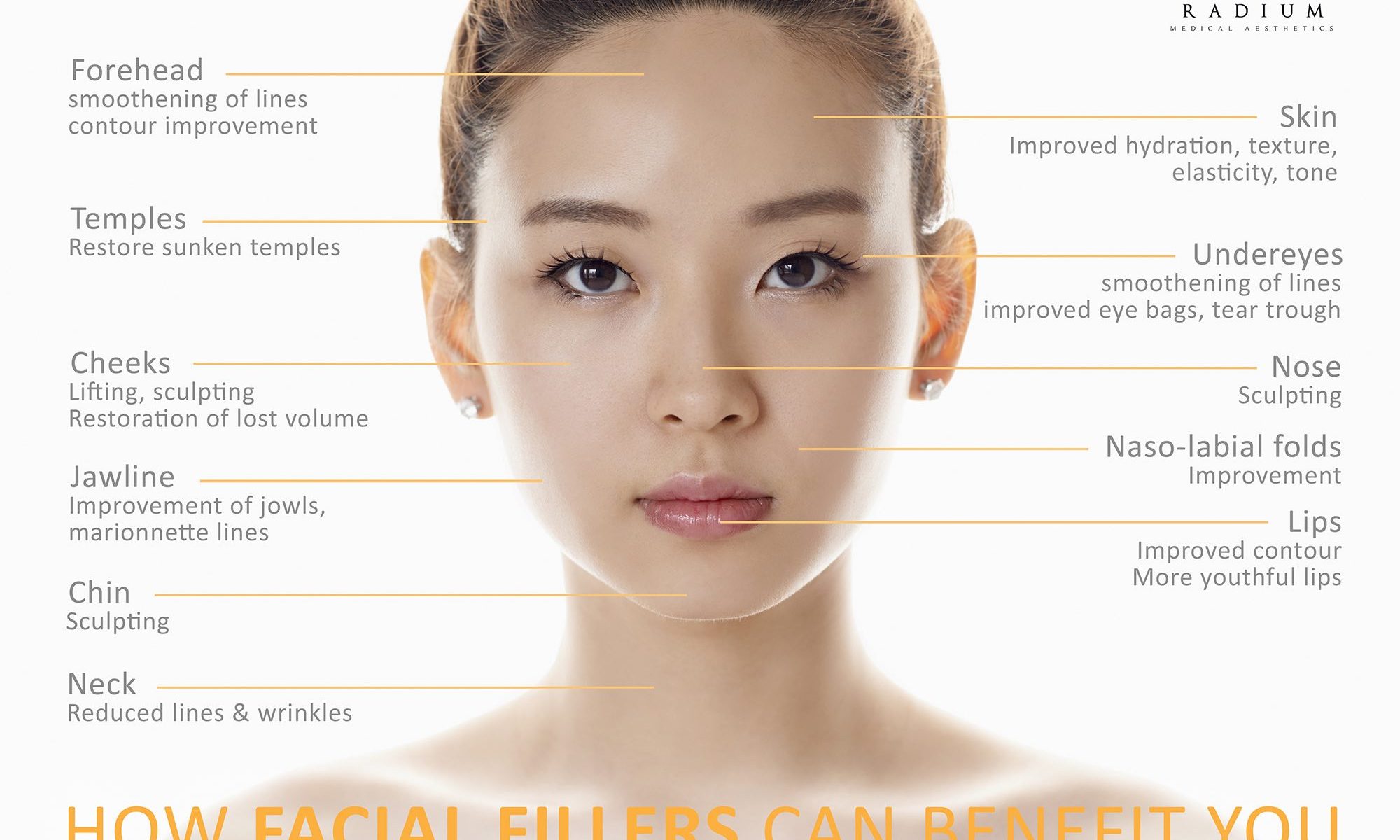 Chin Fillers Singapore