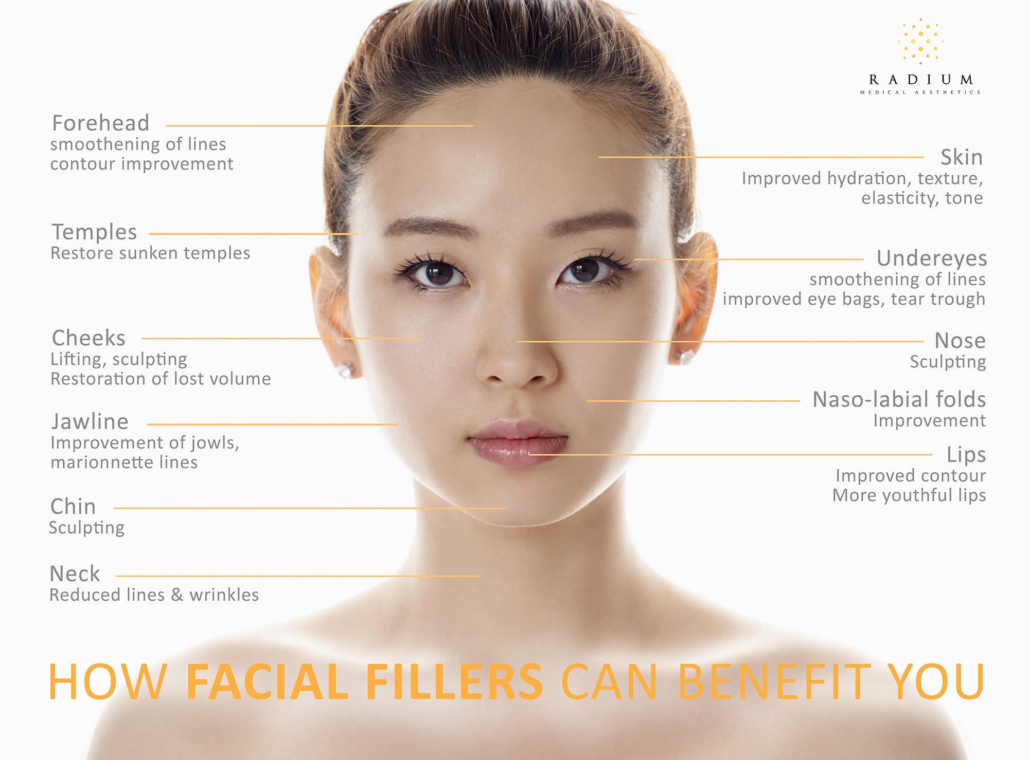 Chin Fillers Singapore