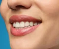 rectpost_image